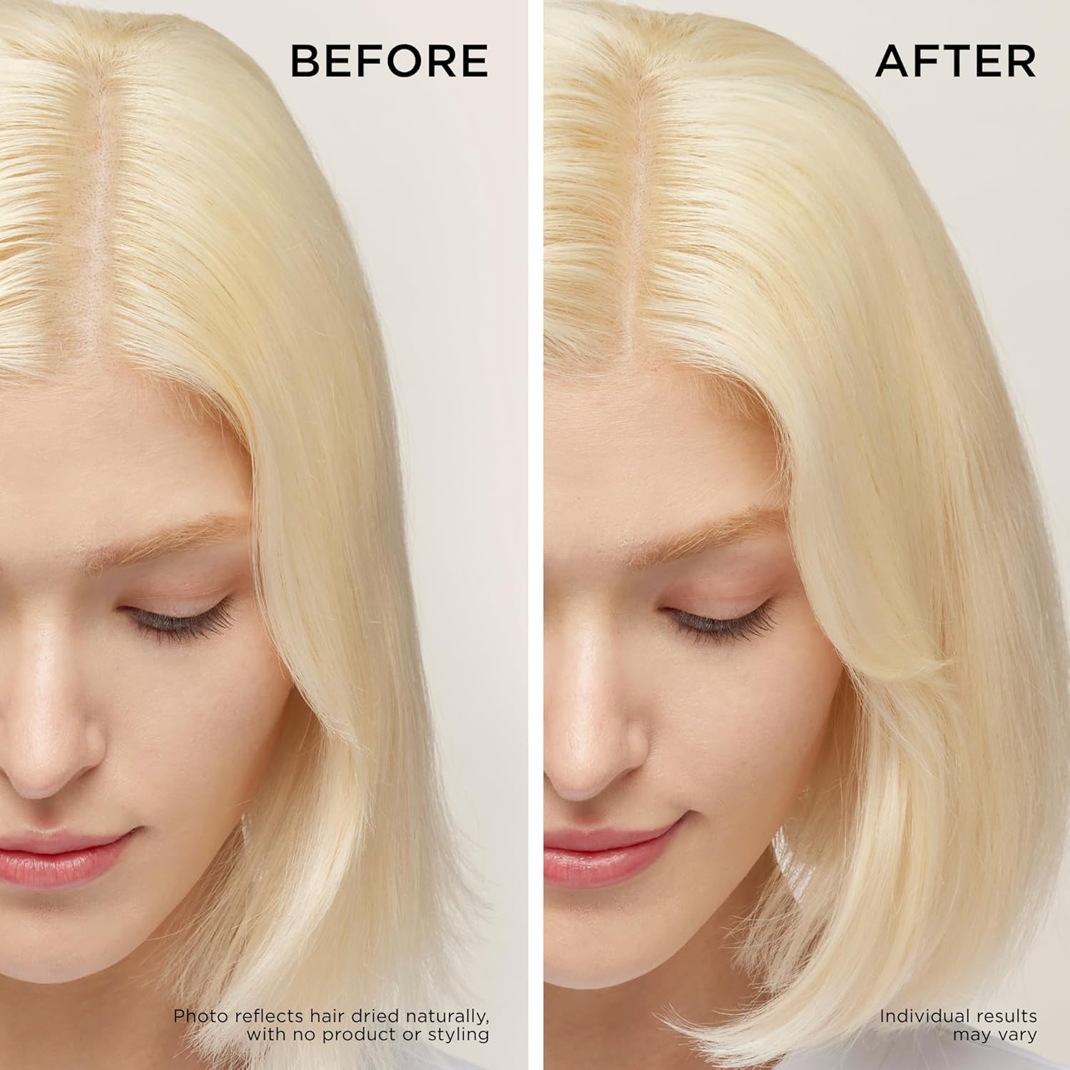 Dr. Groot Thickening Shampoo & Scalp Treatment Set for Hair Loss – Clinical Results with Biotin and Rosemary for Hair Thinning, Shedding, Scalp Repair and Treatment