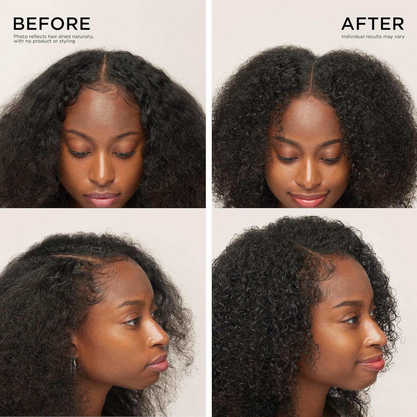 Dr. Groot Award-Winning Hair Thickening Serum for Hair Loss, Korean Hair Care, Scalp Treatment, Clinically Tested, Reduces Oil, Roll On