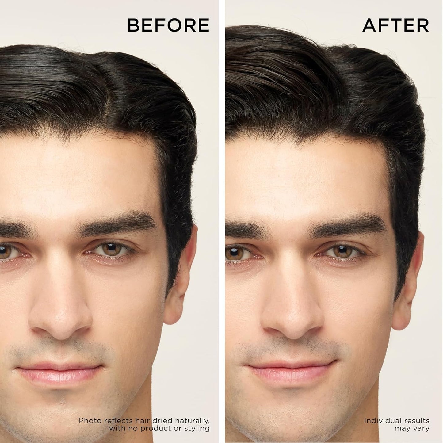 Dr. Groot Thickening Shampoo & Scalp Treatment Set for Hair Loss – Clinical Results with Biotin and Rosemary for Hair Thinning, Shedding, Scalp Repair and Treatment